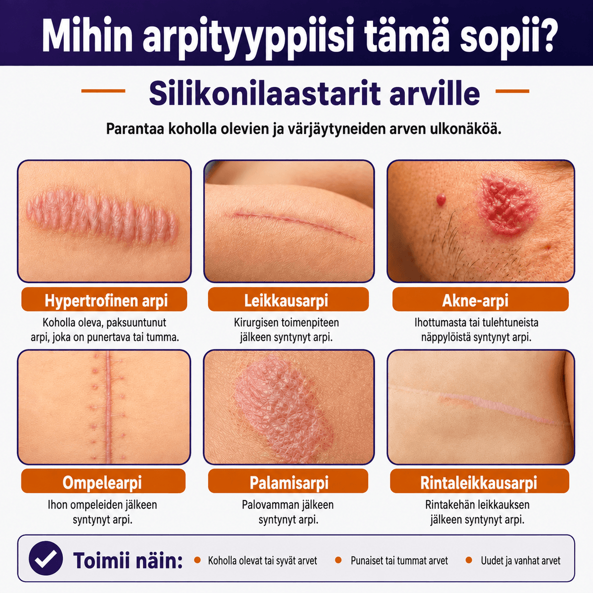 Arpilaastari – Premium-lääkinnällinen silikoni | 3 metrin rulla