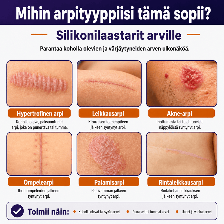 Arpilaastari – Premium-lääkinnällinen silikoni | 3 metrin rulla